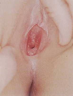 FOTO PRENATAL SEXUAL foto prenatal sexual: