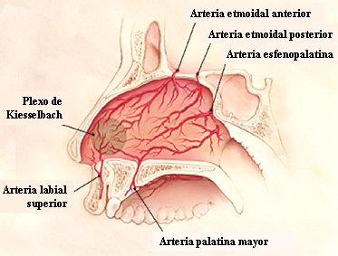 Industrializar Converger Dar derechos Epistaxis: ¿cuándo estudiar? - Medwave