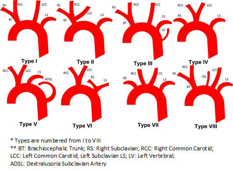 Anatomic variations of the branches of the aortic arch in a Peruvian