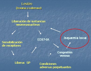 Fisiopatología del dolor musculoesquelético crónico - Medwave